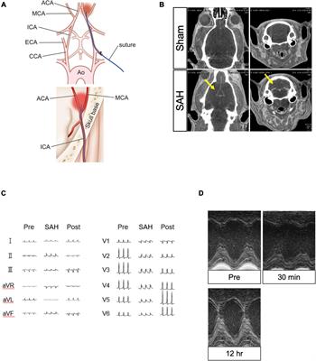 Assessment of cardiac function in rat endovascular perforation model of subarachnoid hemorrhage; A model of subarachnoid hemorrhage-induced cardiac dysfunction